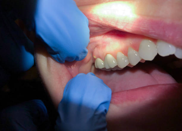Best Pediatric Emergency Dentist in Waukomis, OK