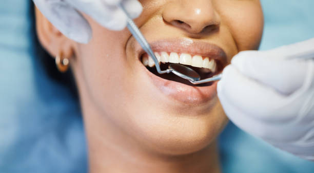 Best Emergency Tooth Extraction in Waukomis, OK