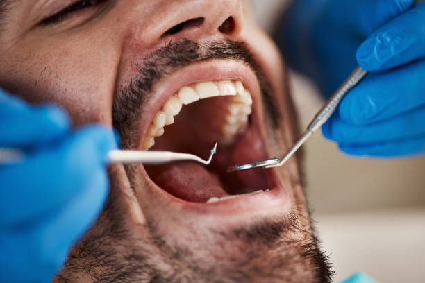 Best Emergency Dental Care for Broken or Chipped Teeth in Waukomis, OK